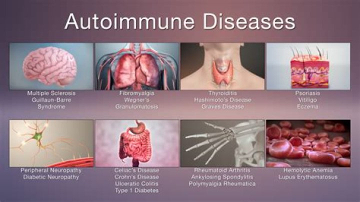 Can autoimmune inner ear disease be cured?