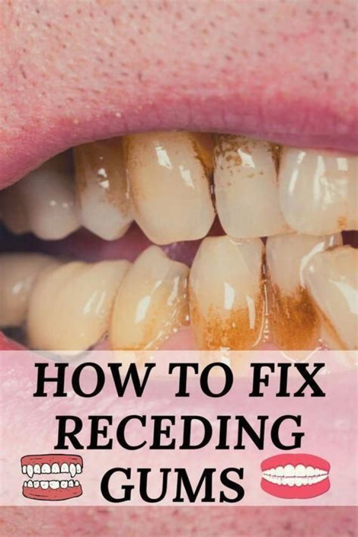 Can I fix receding gums?