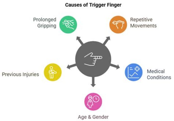 Can playing guitar cause trigger finger?