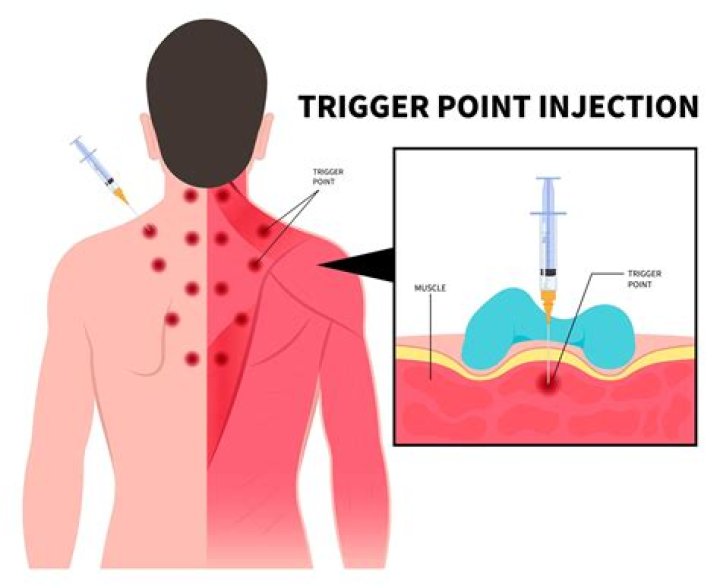 Can trigger point injections cause high blood pressure?