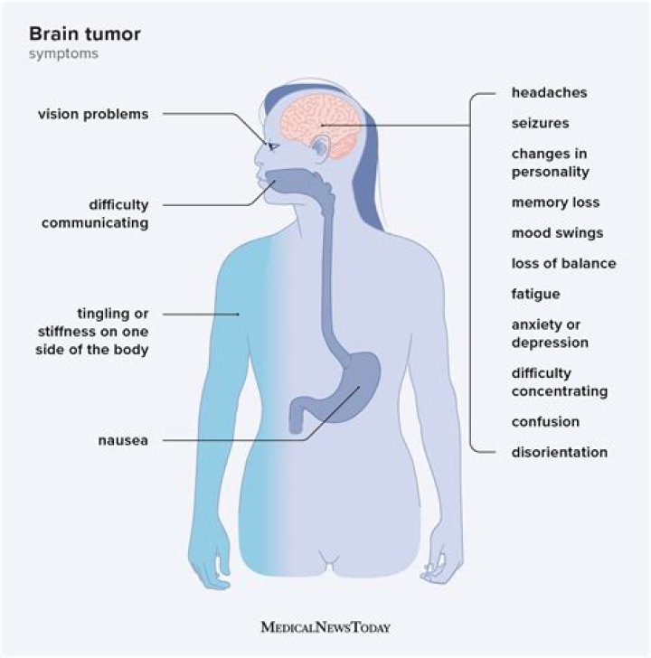 Can you feel a brain tumor lump?