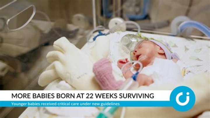 Do 25 week babies survive?