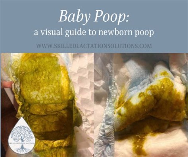 Do newborns poop after every feed?