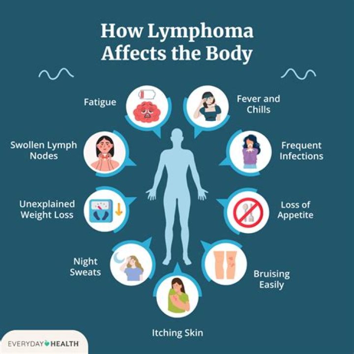 Do people with lymphoma sleep a lot?