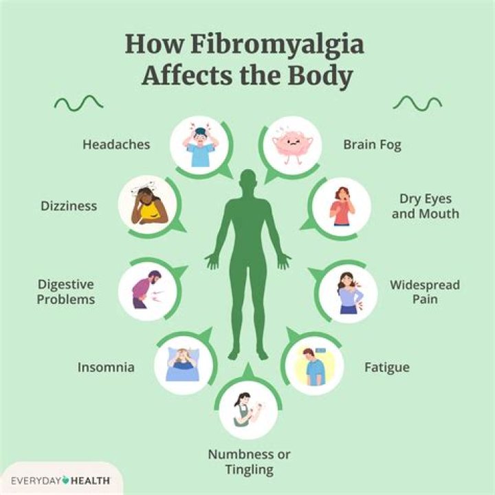 Does fibromyalgia feel like arthritis?