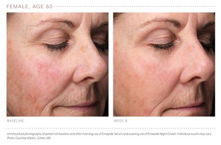 Does low estrogen cause itchy skin?