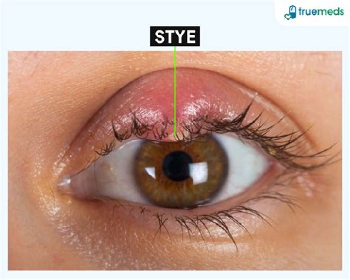 Does reynas eye have a range?