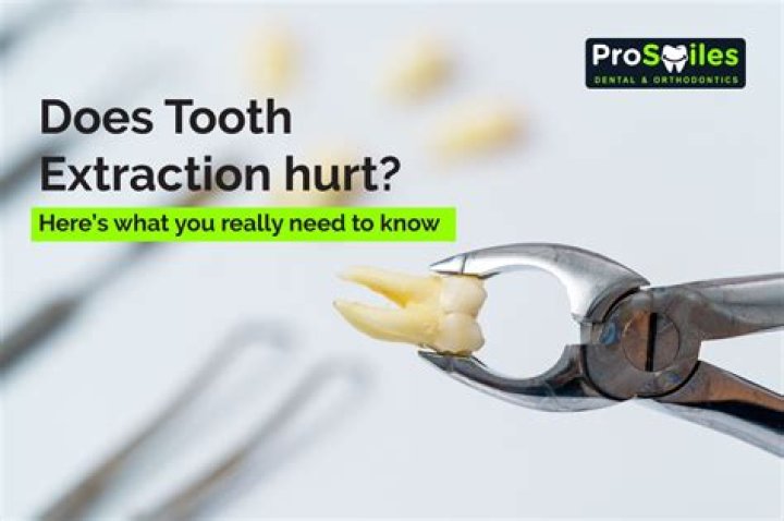 Does tooth extraction injection hurt?
