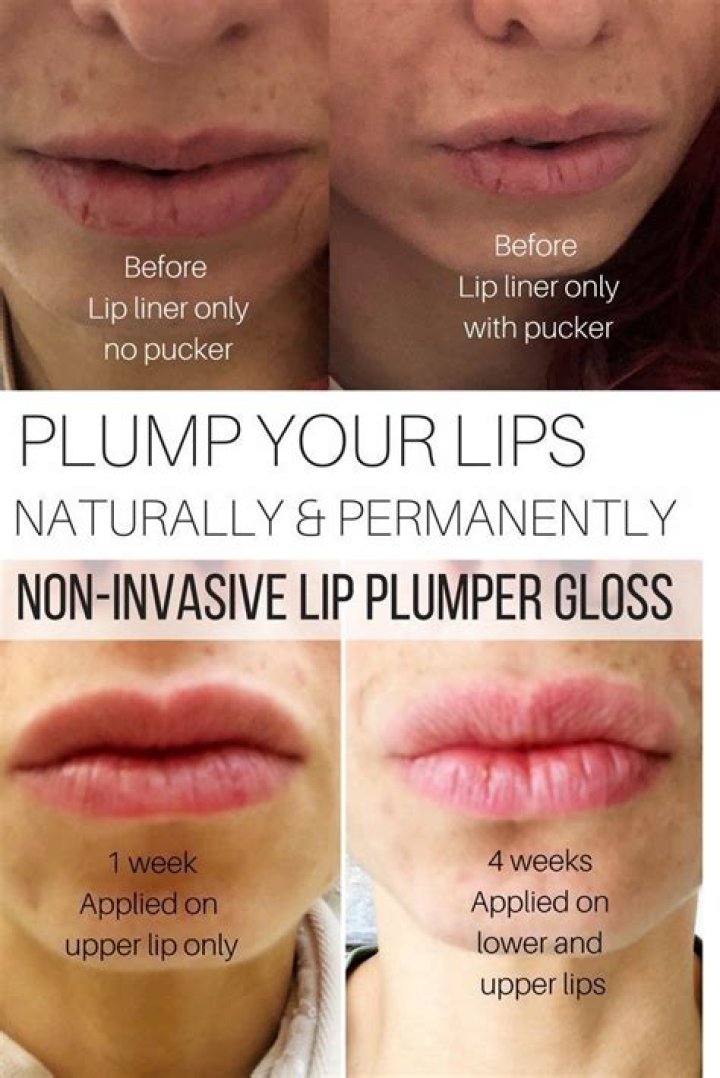 How can I permanently plump my lips naturally?