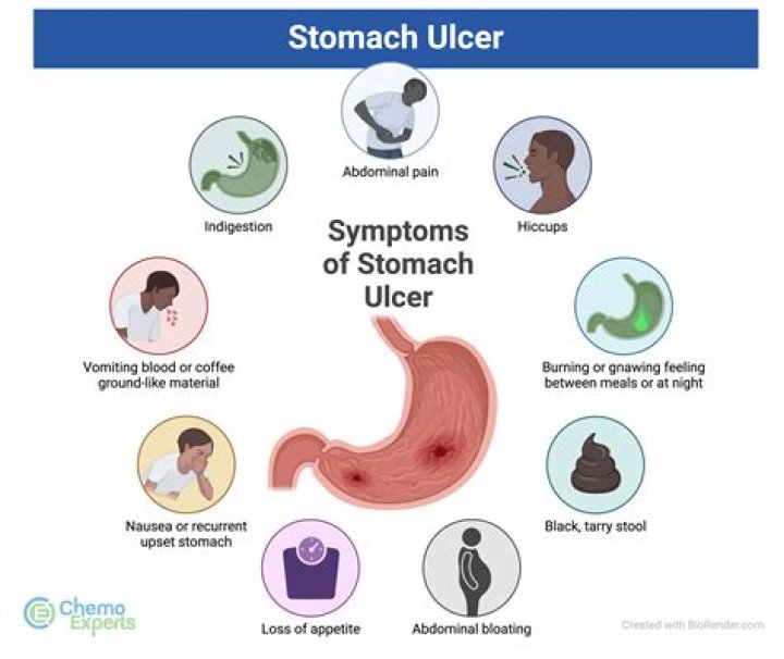 How long does it take for a stomach ulcer to heal?