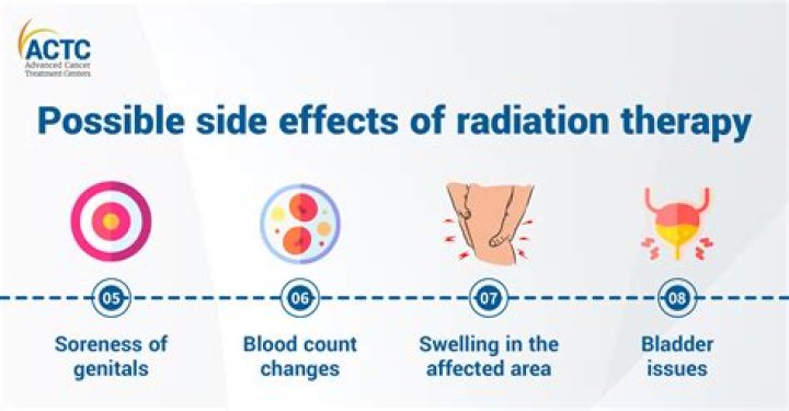 What does radiation fatigue feel like?