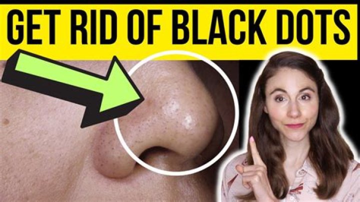 What is the black stuff in octopus head?