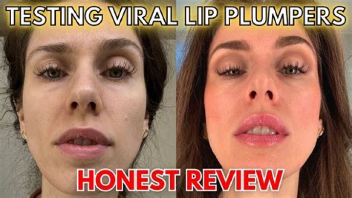 What is the most effective lip plumper?