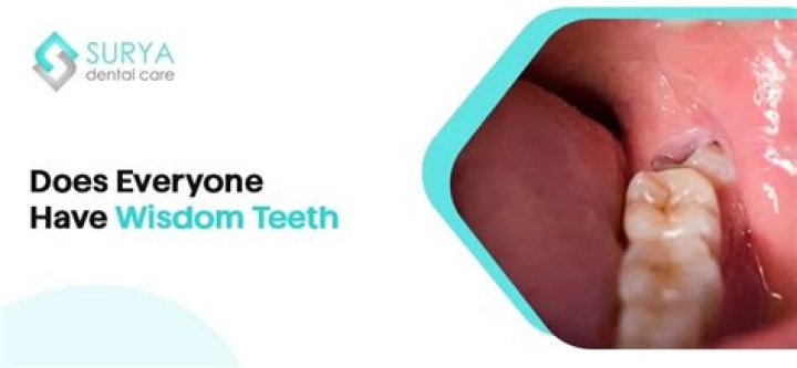 What percentage of people have wisdom teeth?
