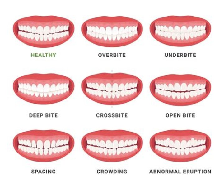 Which teeth should touch?