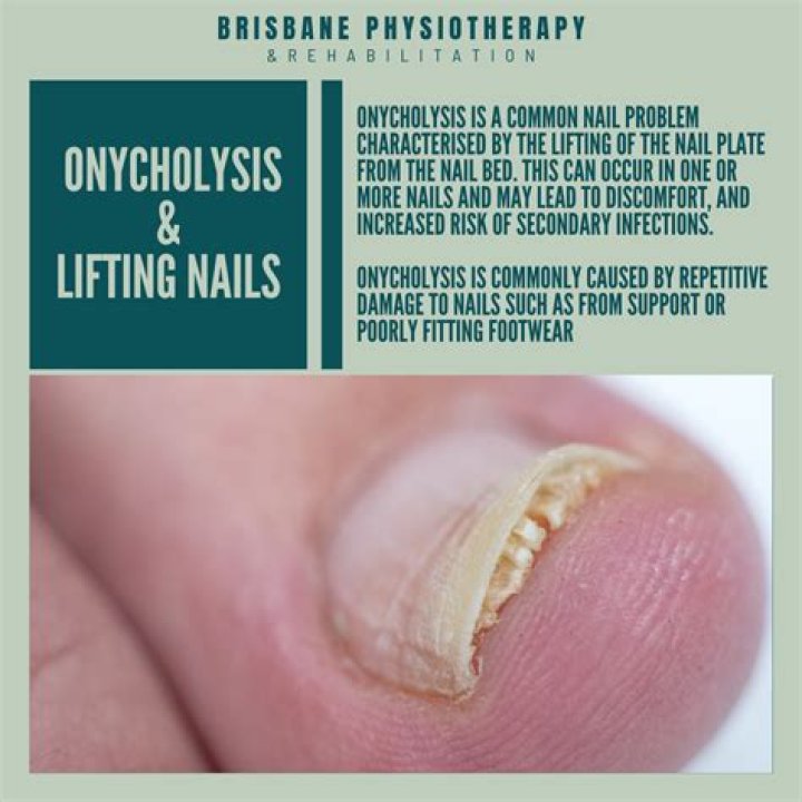 Why is my nail growing two nails?