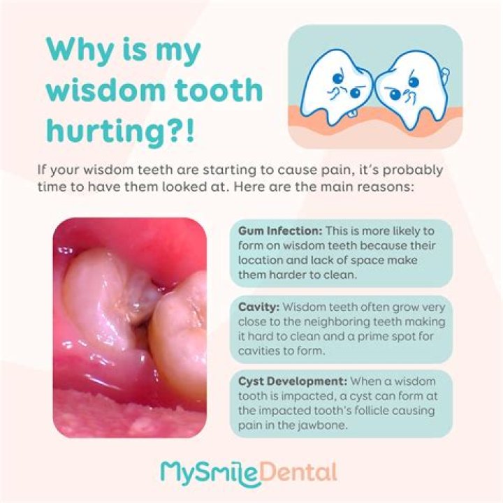 Why is my wisdom tooth cutting my cheek?