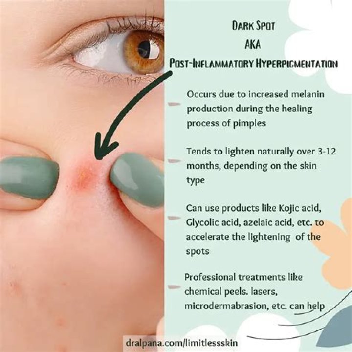 Will dark spots from acne go away?